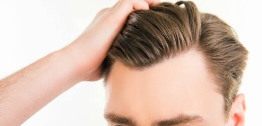 Widows Peak Hairlines