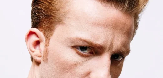 Hairline Widows Peak