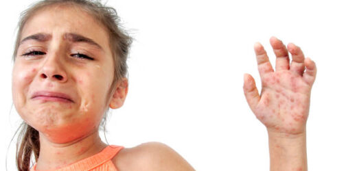 8 Unexpected Causes of Summertime Rashes