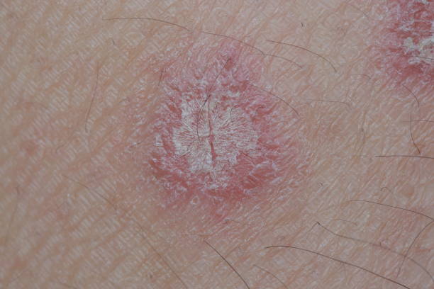 Identifying Skin Growths and Other Skin Problems