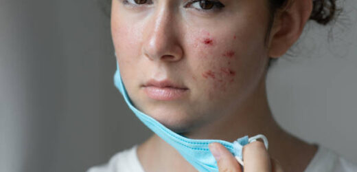 10 Dos and Don’ts for Scar Prevention