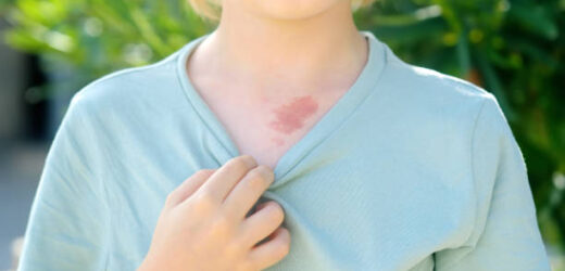 8 Unexpected Causes of Summertime Rashes