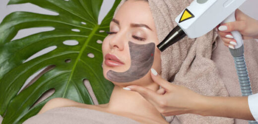 What is a chemical peel and what does it do for your skin?