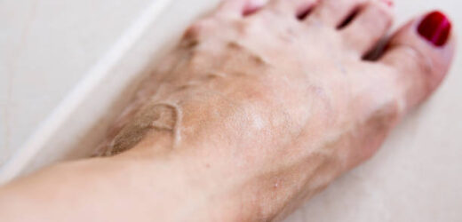 Damaged skin barrier? How to repair and take care of it