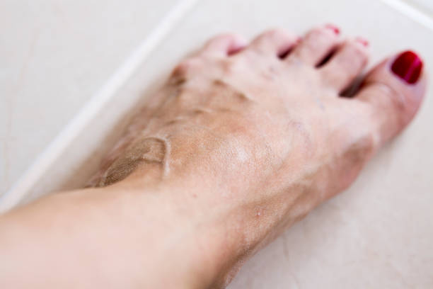 Damaged skin barrier? How to repair and take care of it