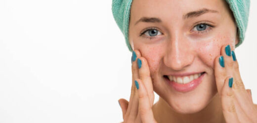 10 essential makeup tips to conceal rosacea