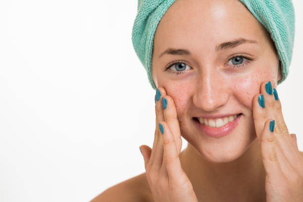 10 essential makeup tips to conceal rosacea